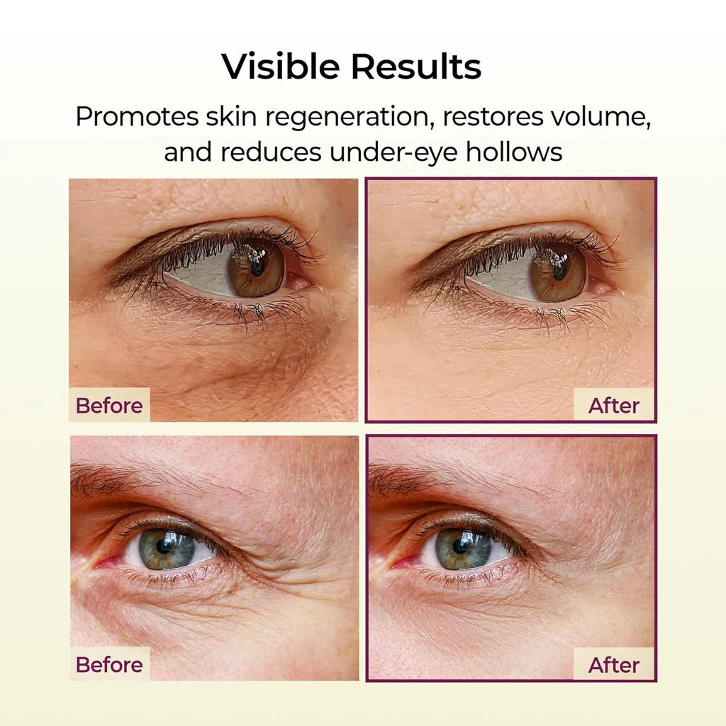 Revitalize Your Eyes with Dr. Melaxin | Cemenrete Calcium Multi Balm - The Ultimate Solution for Youthful, Firm Skin