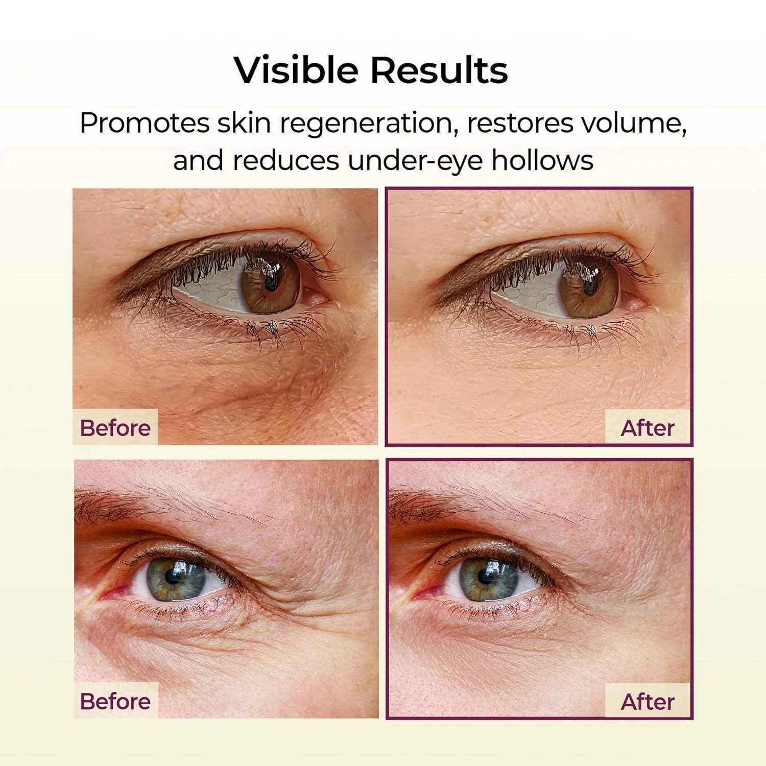 Revitalize Your Eyes with Dr. Melaxin | Cemenrete Calcium Multi Balm - The Ultimate Solution for Youthful, Firm Skin